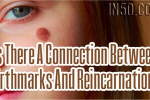 Is There A Connection Between Birthmarks And Reincarnation?