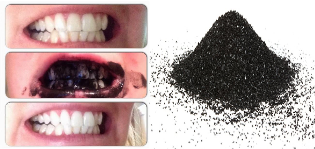 Benefits of Activated Charcoal: Medicine of the Egyptians, Greeks, and Native Americans 