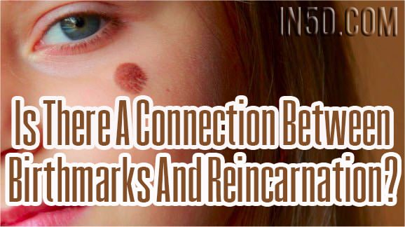 Is There A Connection Between Birthmarks And Reincarnation?
