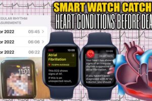 Early Detection: Smart Watch Catches Heart Conditions Before Death